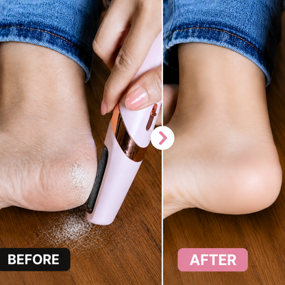 HeyGirl™ Electric Foot Callus Remover